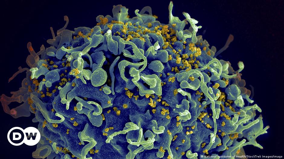 HIV/AIDS needs billions in funding to avoid 'deep problems' |  DW |  04.08.2022