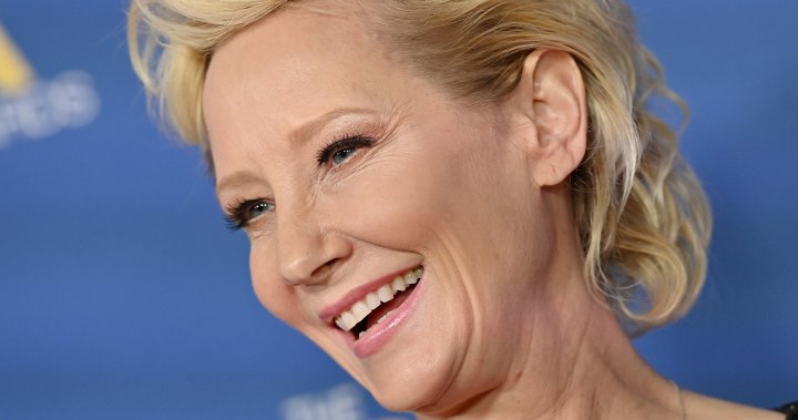 Anne Heche in coma after car crash remains in critical condition - National |  Globalnews.ca