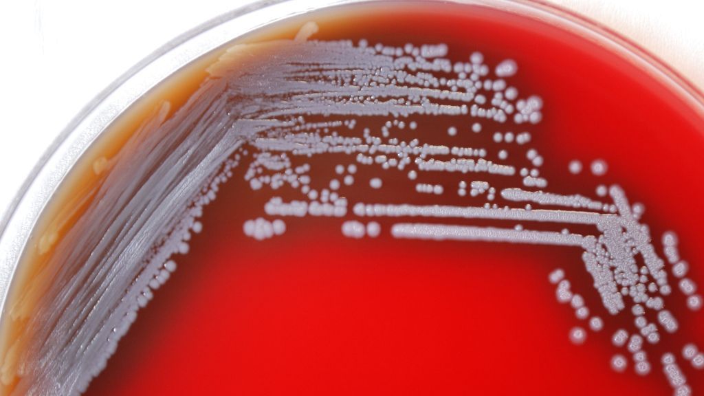 lab dish containing a red culture liquid and the bacteria Burkholderia pseudomallei