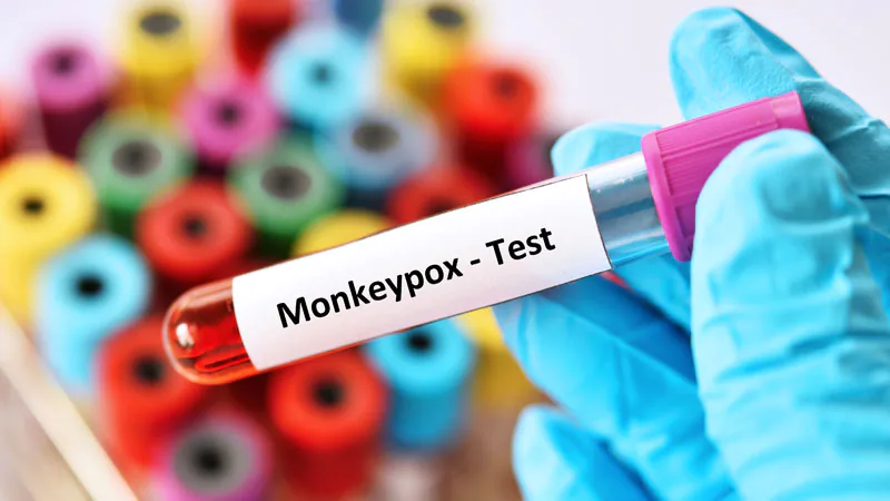 Monkeypox: Stop Testing Lesions Alone