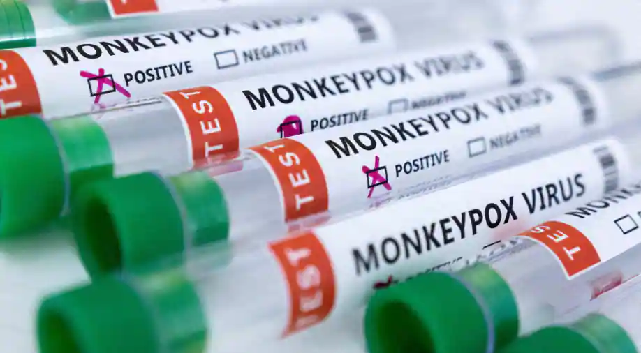 The US is trying to expand supplies of monkeypox vaccines