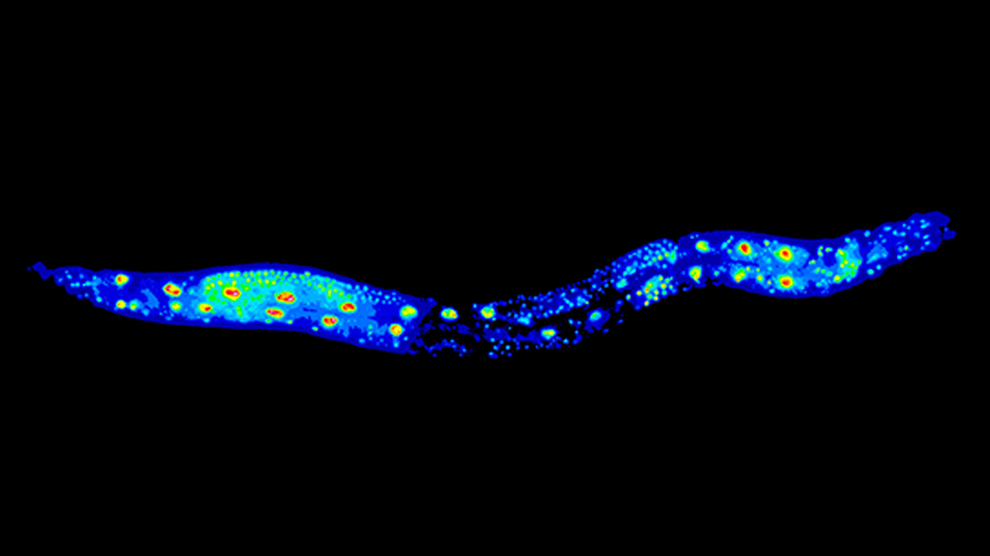 Study examines longer life through defective RNA processing