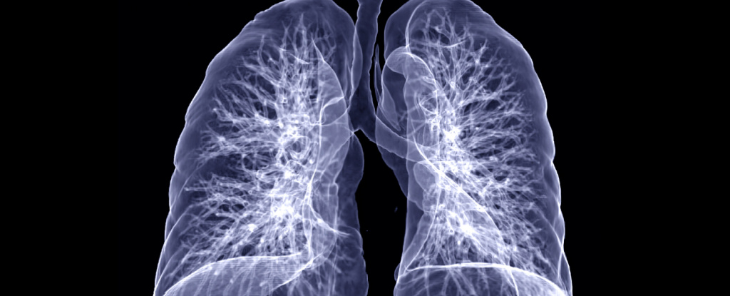 Still short of breath?  Here are 3 ways COVID-19 can cause long-term damage to the lungs