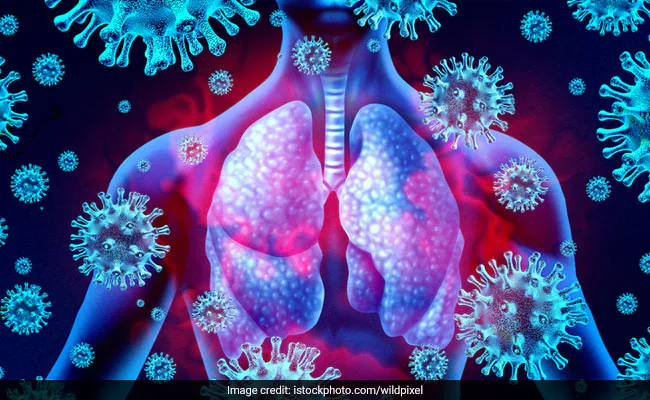 COVID-19 Can Cause Lasting Lung Damage - 3 Ways Long Covid Patients Can Suffer