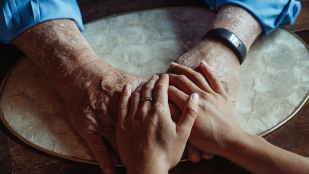 Experts call for better dementia care in a new report, saying most patients don't receive treatment after diagnosis