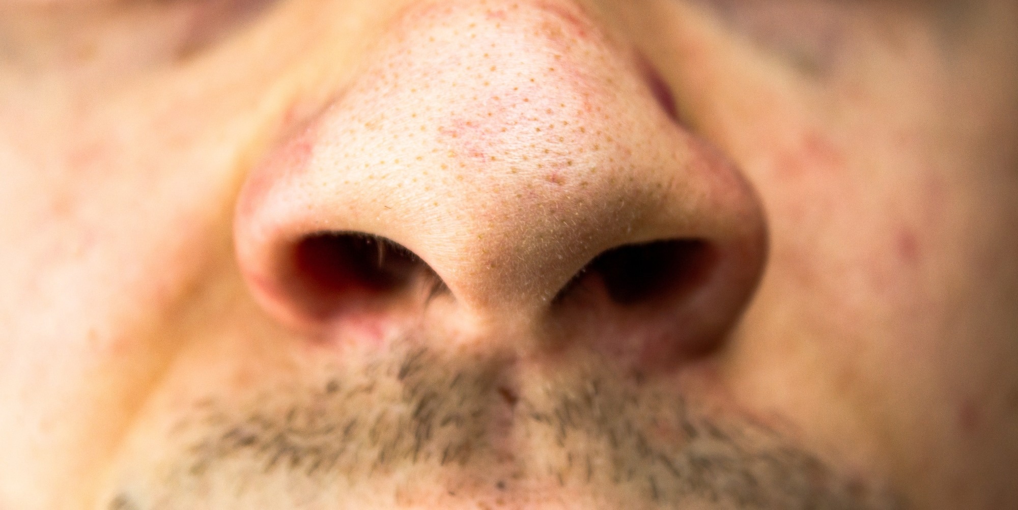 Study: Nasal IgA wanes 9 months after hospitalisation with COVID-19 and is not induced by subsequent vaccination. Image Credit: BINK0NTAN / Shutterstock