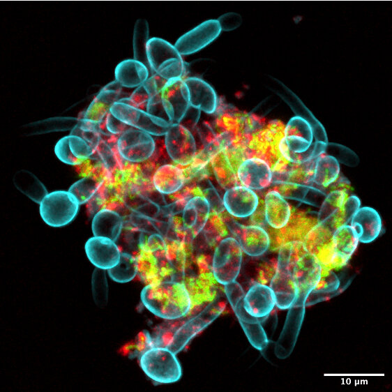 Microbes that cause tooth decay can create superorganisms that can "crawl" and spread onto teeth