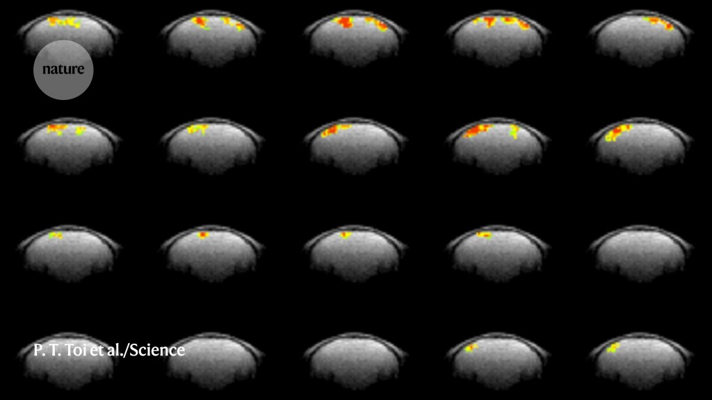 A faster MRI scan captures brain activity in mice