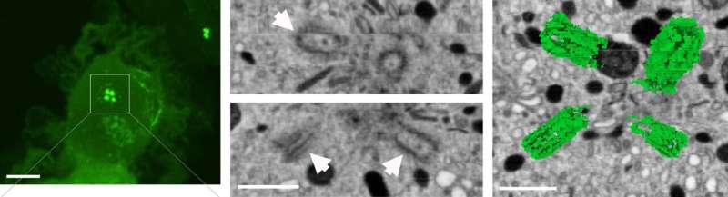 Newly discovered process revs up immune cells