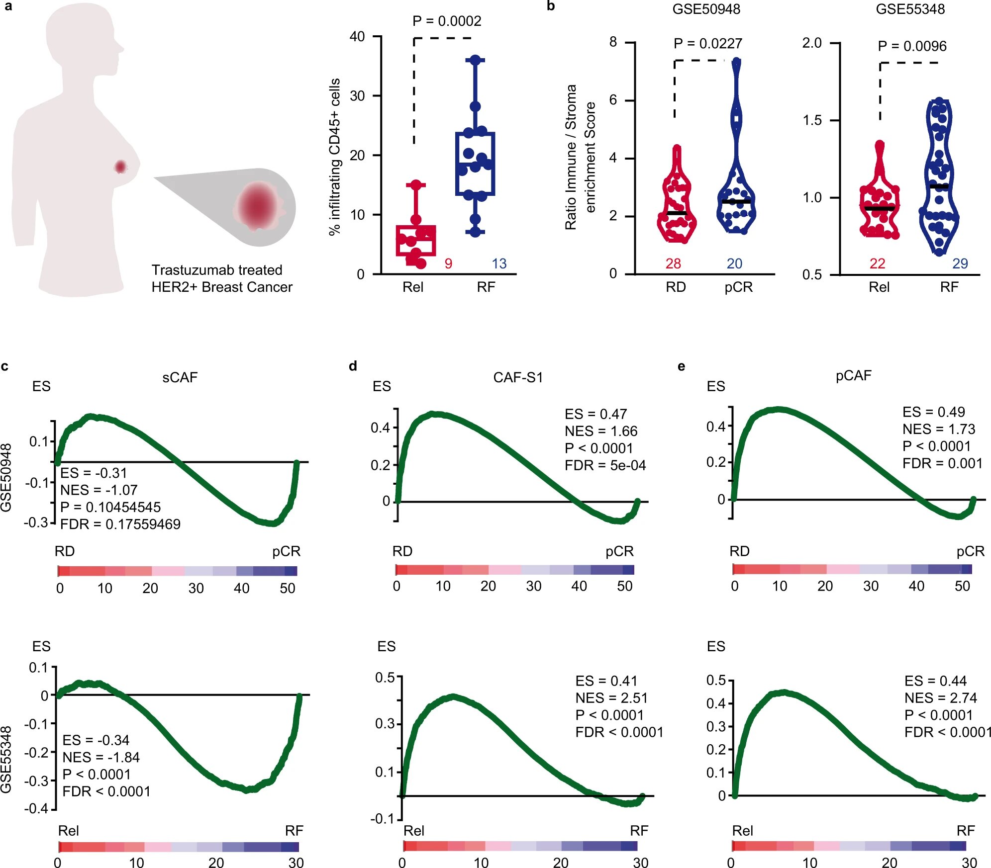 Researchers are overcoming treatment resistance mechanisms in one of the most aggressive types of breast cancer