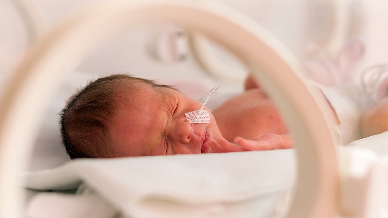 Related: Preterm Infant Program Makes Progress