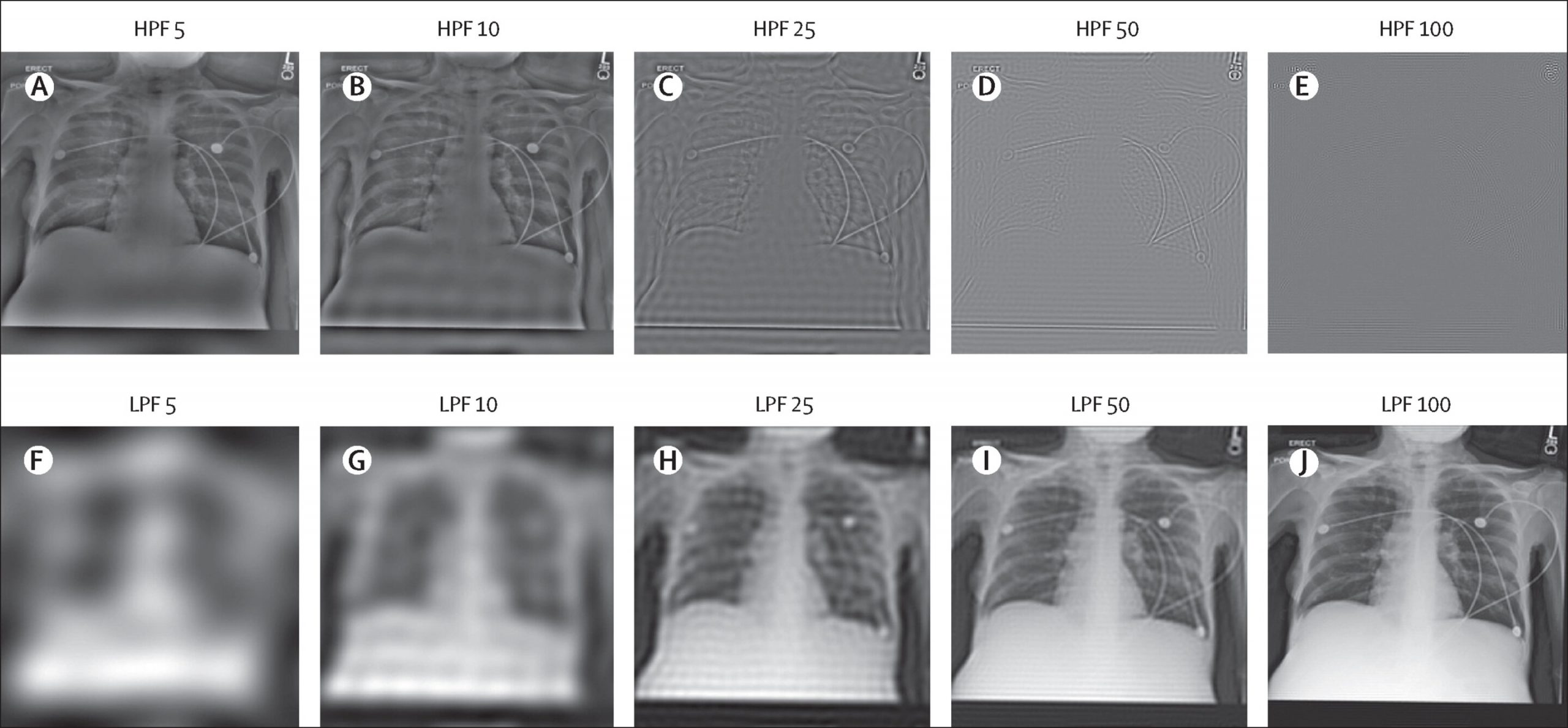 Study shows artificial intelligence can determine race based on medical images