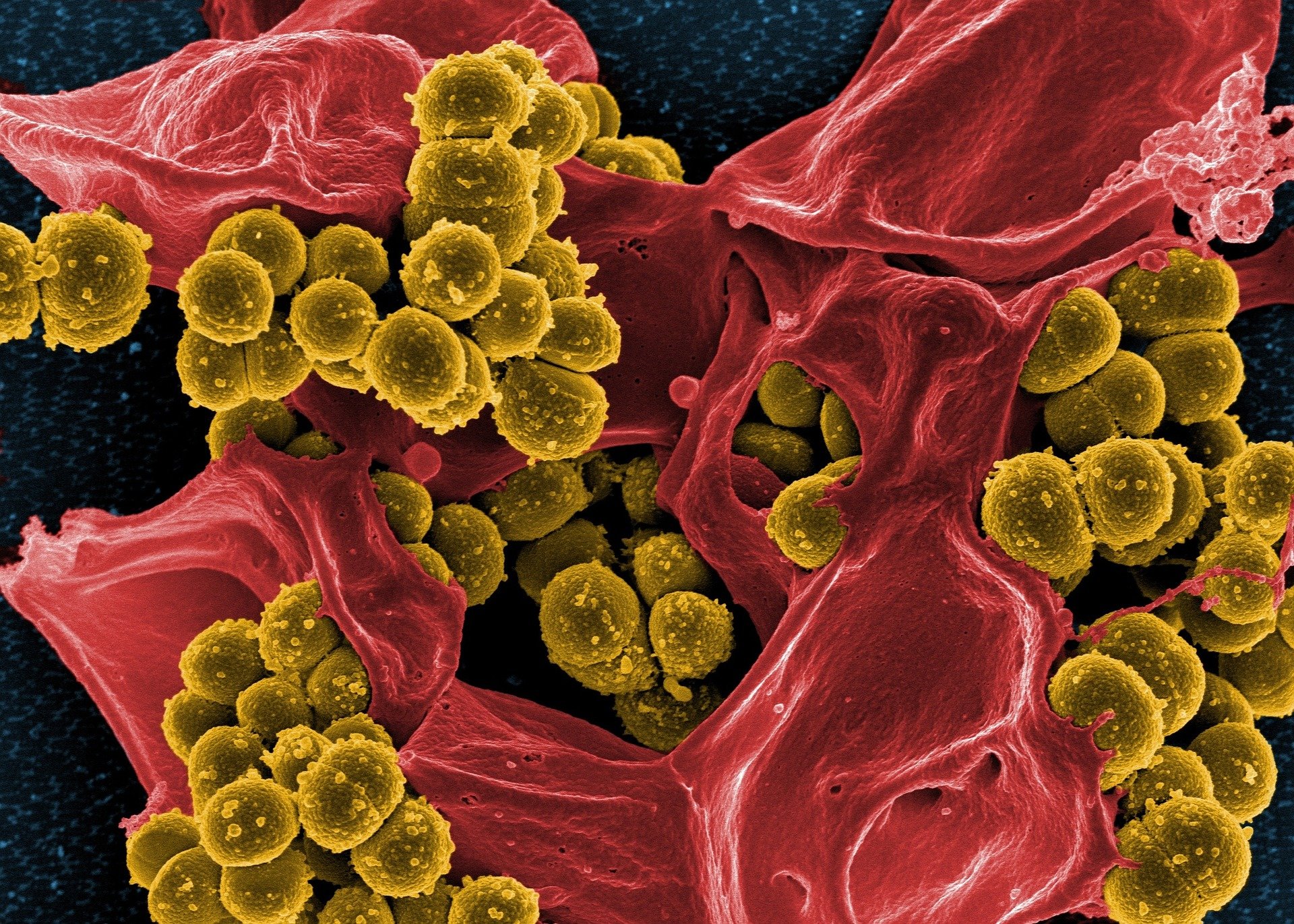 Study shows how naturally occurring compound kills key drug-resistant bacteria