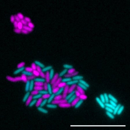 The local environment of a microbe can make the difference between life and death