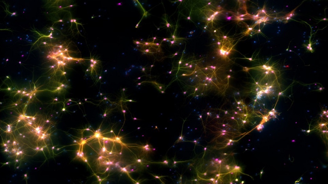 800,000 neurons in a bowl learned to play pong in just five minutes