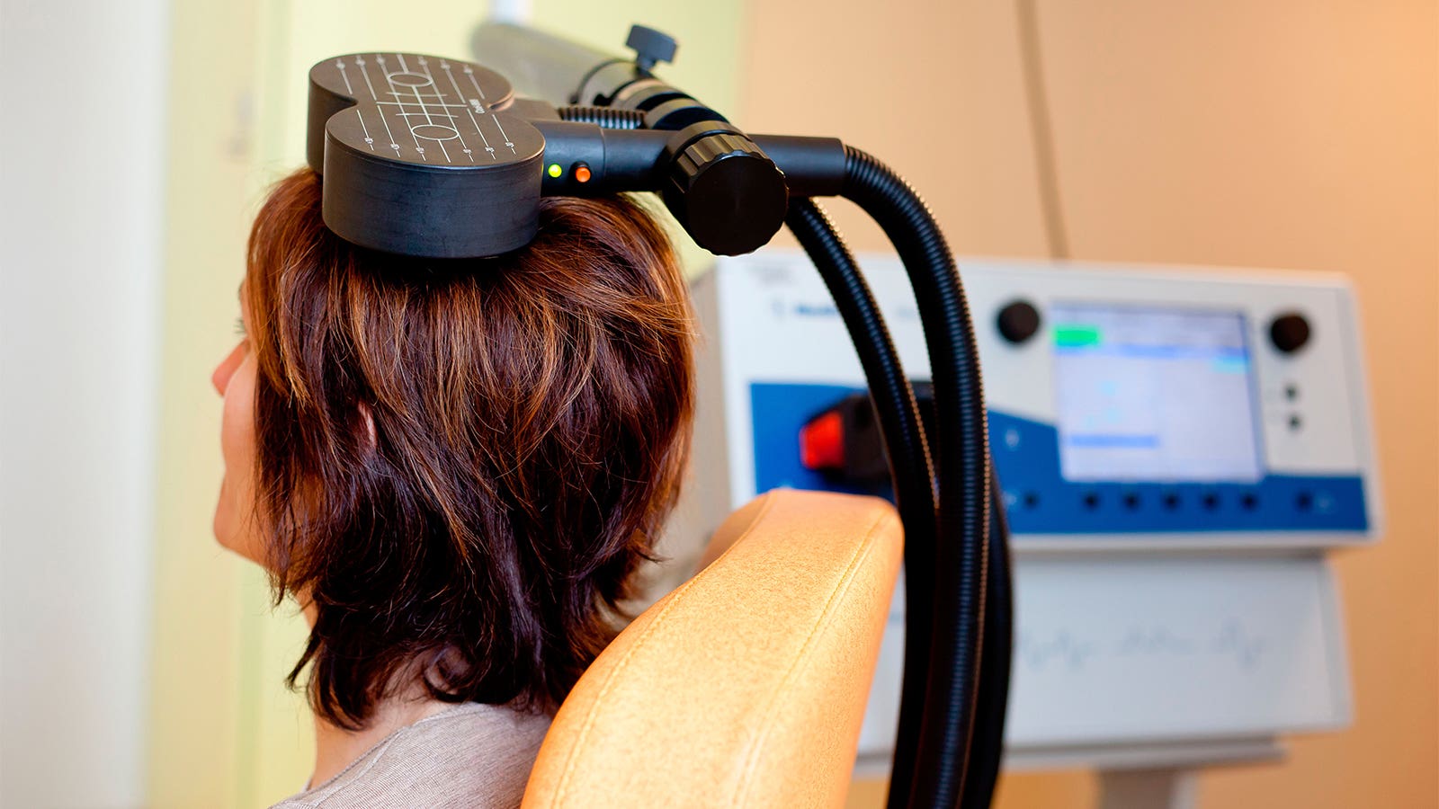 A photo of a woman receiving intermittent theta-burst stimulation.