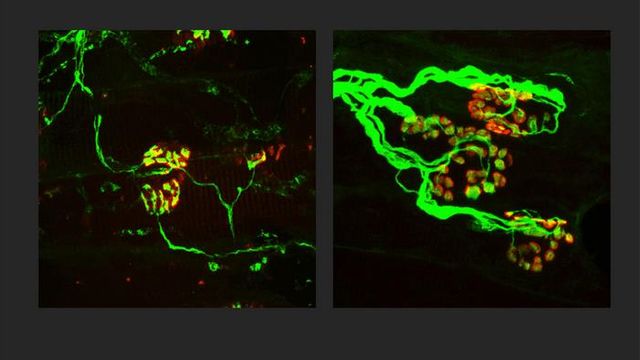 Blocking a 'molecular executioner' could save neurons from Parkinson's