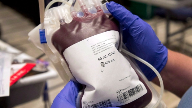 COVID-19 misinformation is leading some patients to refuse blood transfusions from vaccinated donors