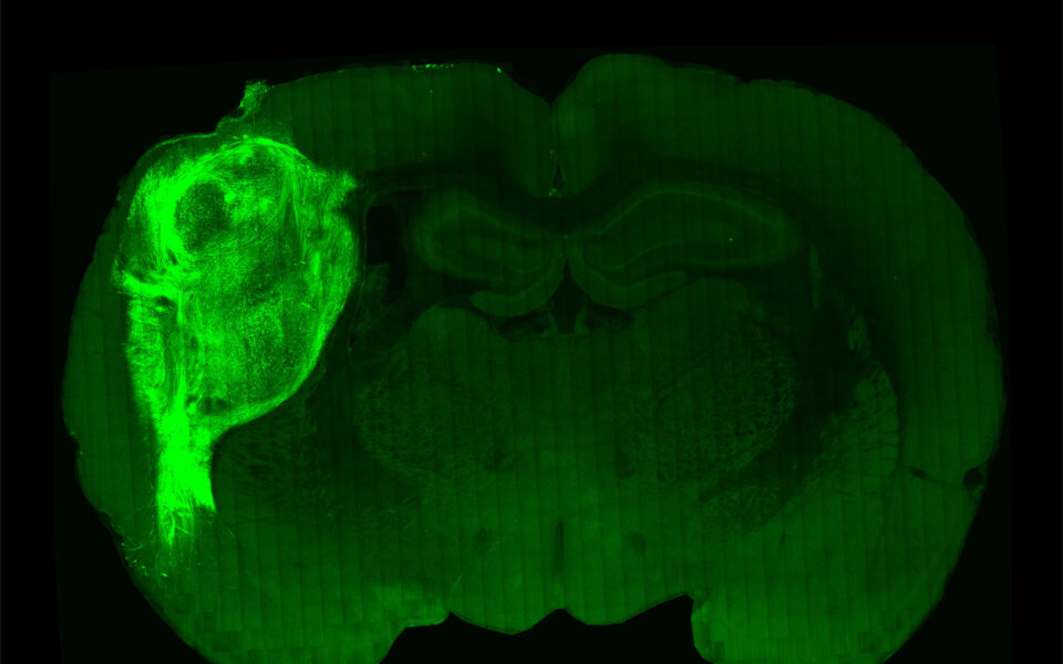 Human brain cells grow in rats and feel what the rats feel  eKathimerini.com