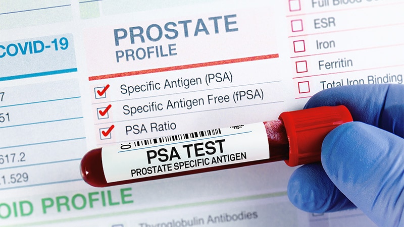 Lower PSA Screening Rates Linked to Rise in Mets Prostate Cancer