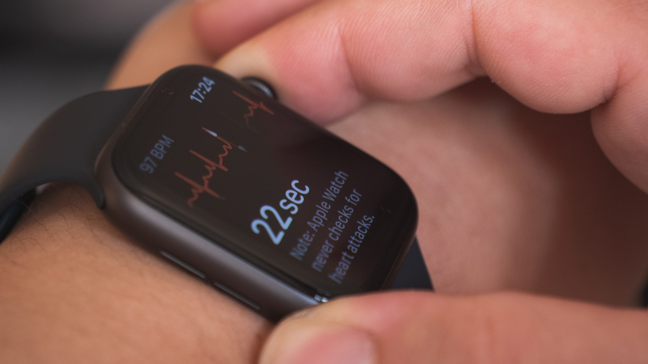 Smartwatch warning: AFib testing reveals 'high rate' of false positives for wearable technology using ECG strips