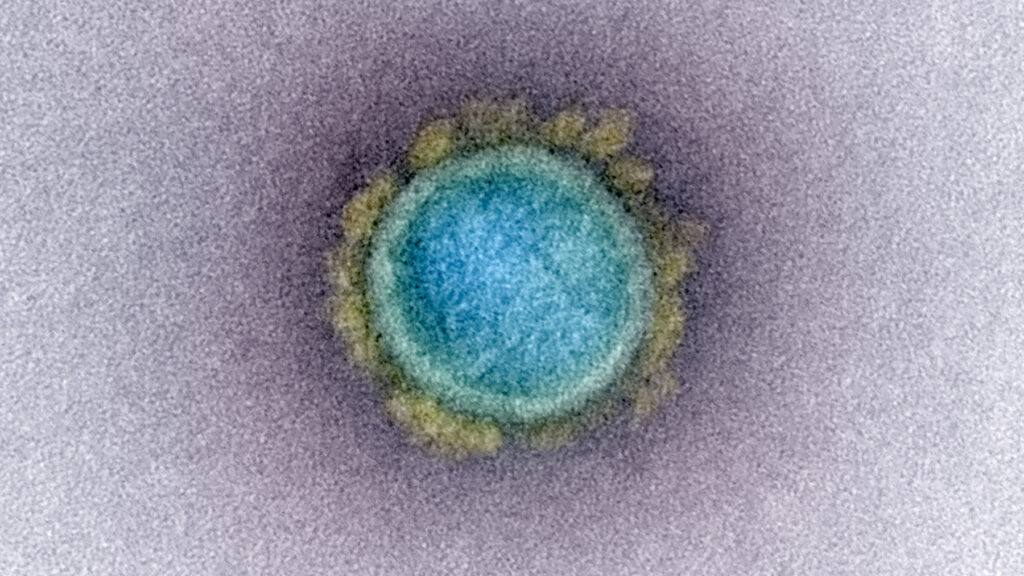 Tests by Boston University researchers on a lab-made version of the Covid virus draw government scrutiny