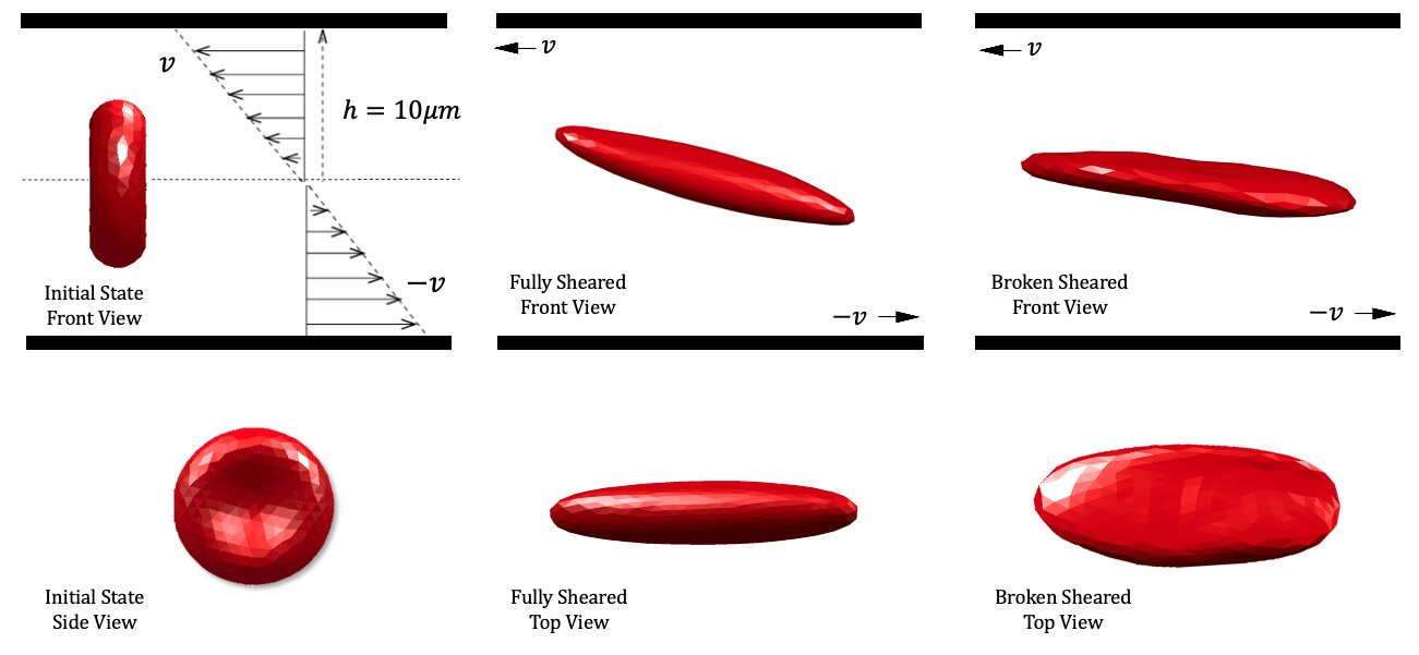 Simulation of shearing destruction of red blood cells